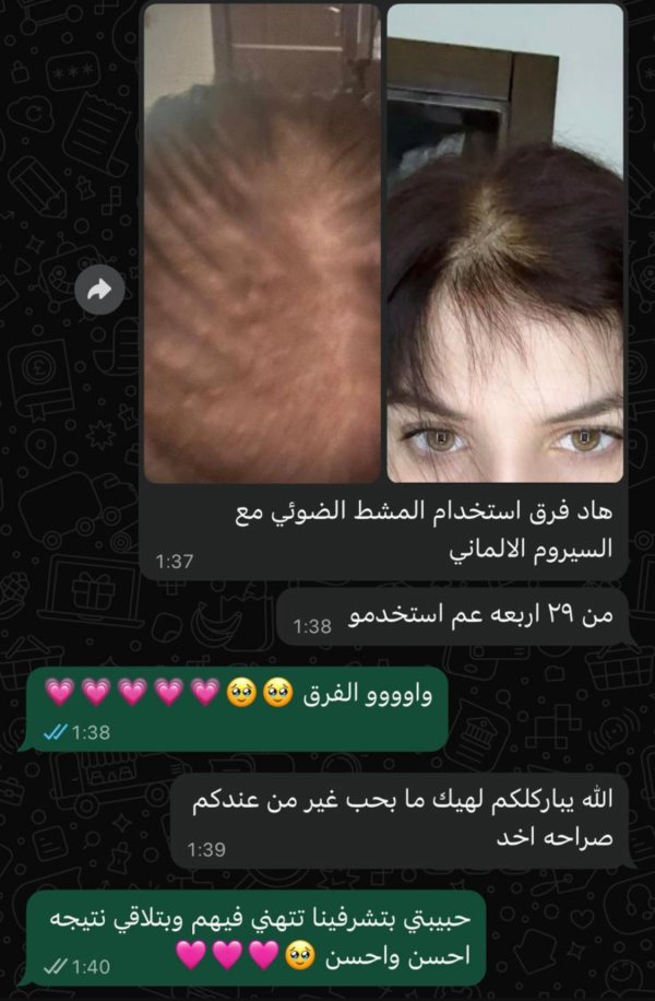 ثيرا برش والتونر الالماني للشعر